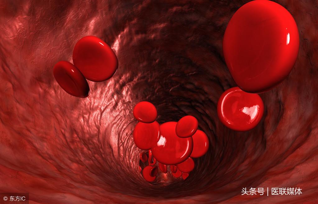 (sd是什么意思)四维彩超sd值是什么意思?孕妇sd值高是什么原因导致的? 第3张 (sd是什么意思)四维彩超sd值是什么意思?孕妇sd值高是什么原因导致的? 第3张
