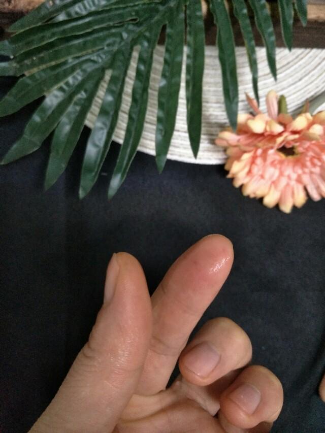 (胶水粘在手上怎样才能快速洗掉)502胶水最怕“它”,把手粘住了只需要这样"泡",就可以快速解除 第9张 (胶水粘在手上怎样才能快速洗掉)502胶水最怕“它”,把手粘住了只需要这样"泡",就可以快速解除 第9张